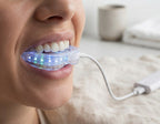 PÚRIVA BrightClean™ LED Teeth Cleaner